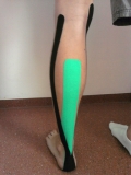 Kineziotaping